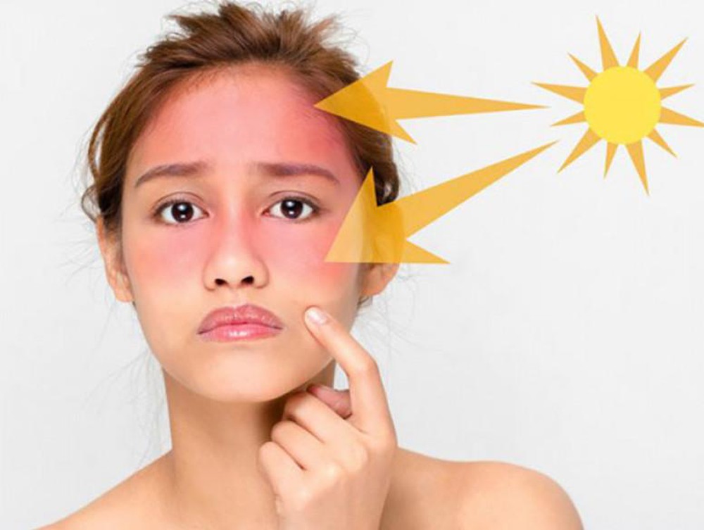 Tác hại của ánh nắng mặt trời đối với làn da là gì? (Nguồn: Internet)