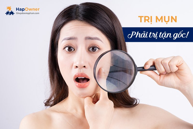 Trị mụn phải nhớ trị tận gốc!